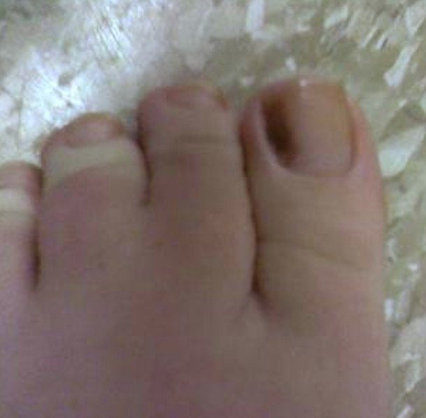 toenail pictures #10