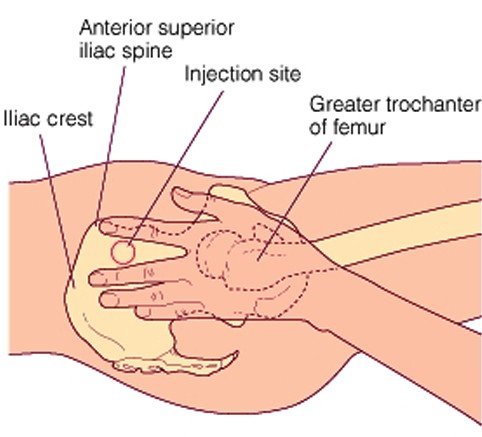 ventrogluteal injection site